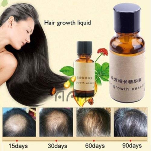 Alicenter(TM) Original Hair Growth Pilatory Essence Oil Baldness Alopecia anti Loss New