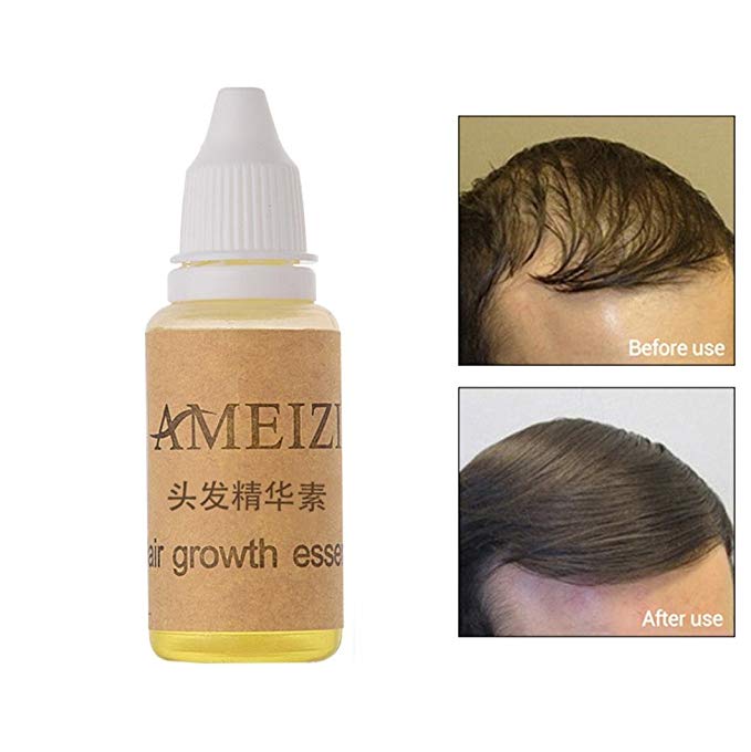 Inkach - - Hair Growth Serum - Womens Hair Loss Thinning Supplement - Repair Hair Essence Oil 20ML