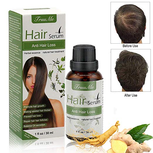 Hair treatment, Hair growth serum, Hair serum, Natural Herbal Essence Anti Hair Loss Hair Serum , For Longer, Thick,Stronger Hair. Hair serum For Men & Women (30ml)