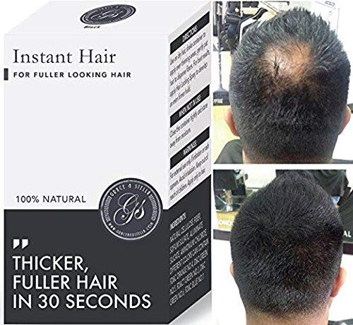 NEW 100% Vegan + Natural Hair Loss Treatment for Men & Women - 100%, Building Keratin Fibers, Concealer, prevention, Make Thinning Hair Thickener (Black) (5 week supply)