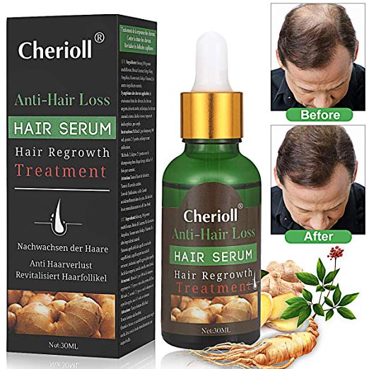 Hair Growth Serum,Hair Loss &Hair Thinning Treatment,Hair Serum,Stimulates New Hair Growth, Promotes Thicker, Fuller and Faster Growing Hair